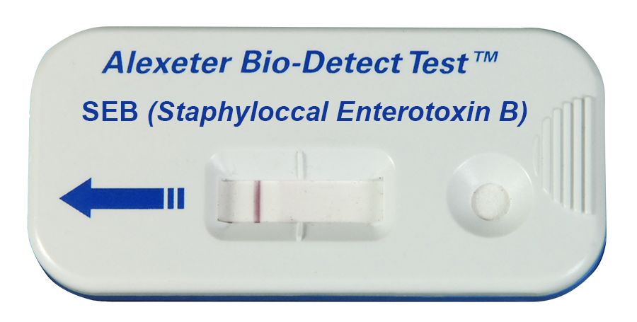 SEB Kit (25/box) — P/N 1670-0006